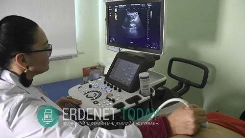 АЖИЛТАН БҮР 300-900 МЯНГАН ТӨГРӨГИЙН ҮЗЛЭГ, ОНОШИЛГООНД ХАМРАГДАЖ БАЙНА